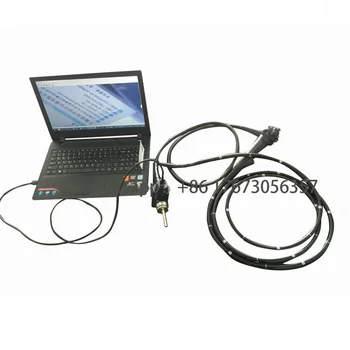Aukštos kokybės vaizdo kolonoskopijos įranga kolonoskopijos aparatas USB nešiojamasis gastroskopasVideo endoskopija